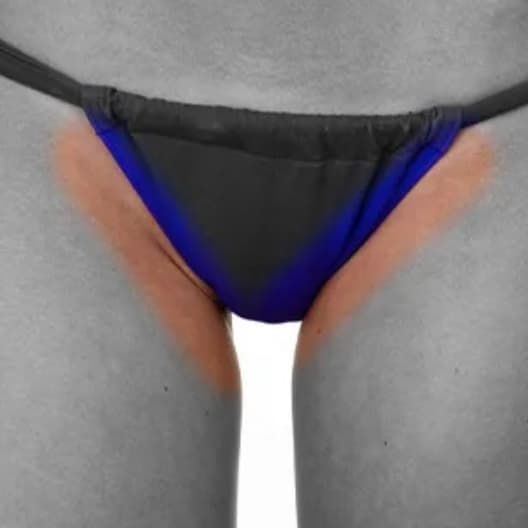 Bikini Line-6 Sessions (WOMEN) at Eclectic Aesthetics in White Plains, NY