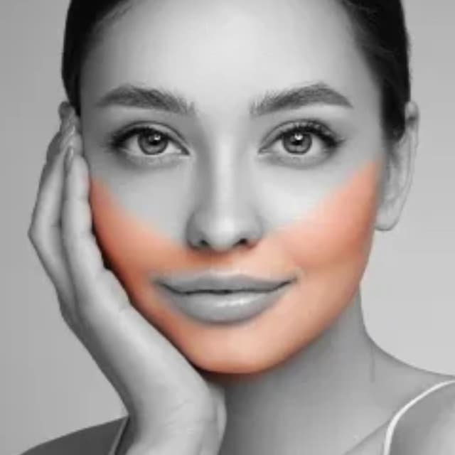 Lower Face-6 Sessions at Eclectic Aesthetics in White Plains, NY