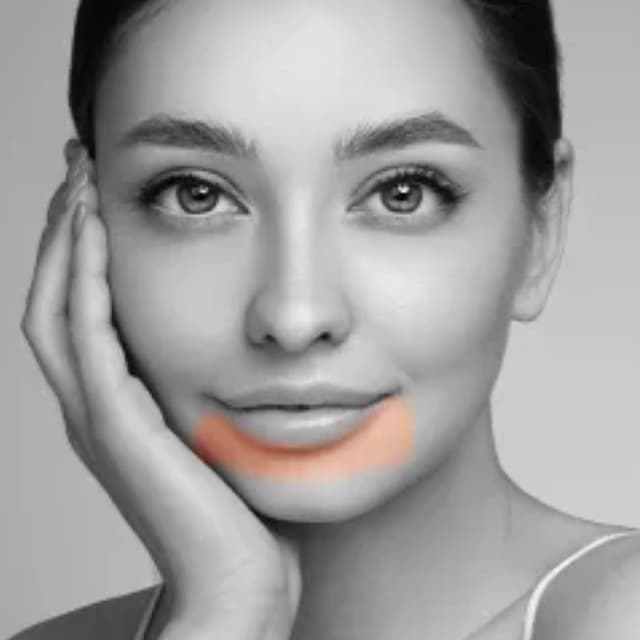 Lower Lip-6 Sessions at Eclectic Aesthetics in White Plains, NY