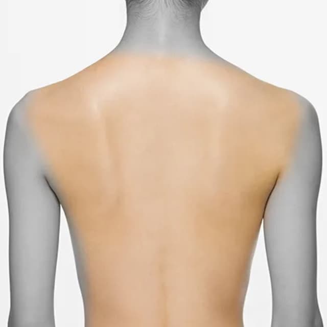 Full Back-6 Sessions (WOMEN) at Eclectic Aesthetics in White Plains, NY