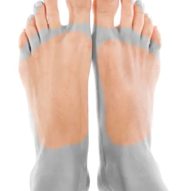 Toes and Feet-6 Sessions at Eclectic Aesthetics in White Plains, NY