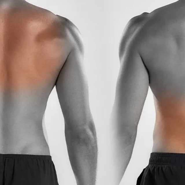 Half Back-6 Sessions (MEN) at Eclectic Aesthetics in White Plains, NY