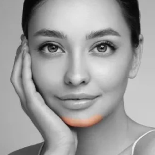 Chin-6 Sessions at Eclectic Aesthetics in White Plains, NY