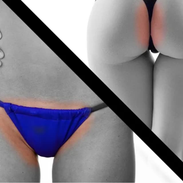 Full Brazilian-Six Sessions (WOMEN) at Eclectic Aesthetics in White Plains, NY