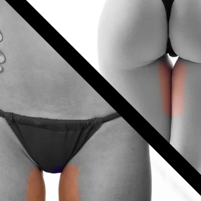 Inner Thigh-6 Sessions (WOMEN) at Eclectic Aesthetics in White Plains, NY