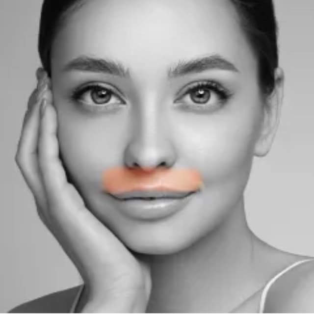 Upper Lip-6 Sessions at Eclectic Aesthetics in White Plains, NY